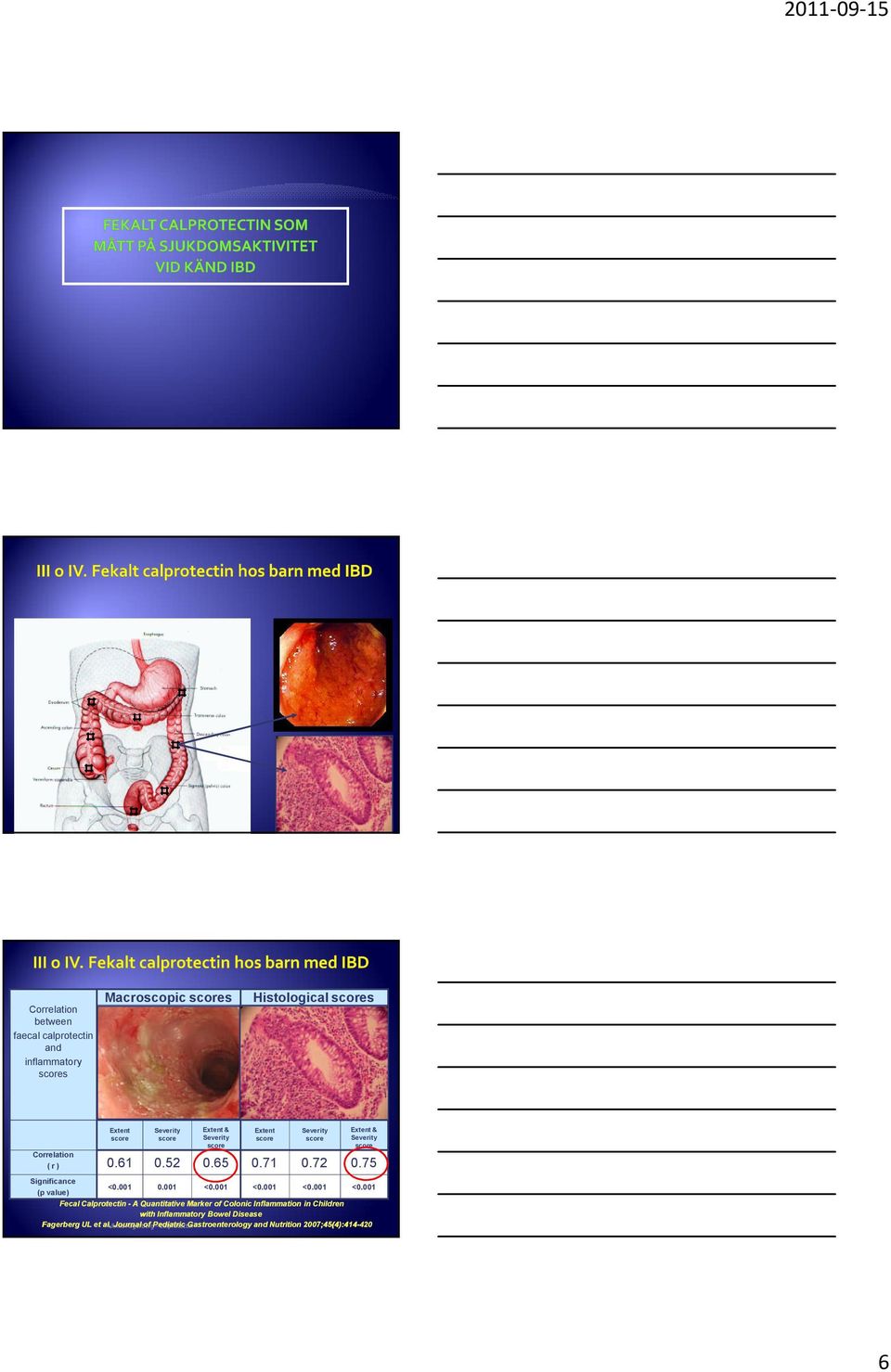 001 <0.001 <0.001 <0.001 Fecal Calprotectin - A Quantitative Marker of Colonic Inflammation in Children with Inflammatory Bowel Disease Fagerberg UL et al.