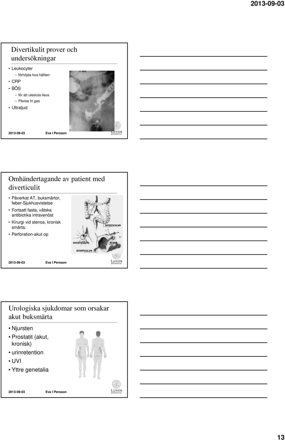 Fortsatt fasta, vätska antibiotika intravenöst Kirurgi vid stenos, kronisk smärta.