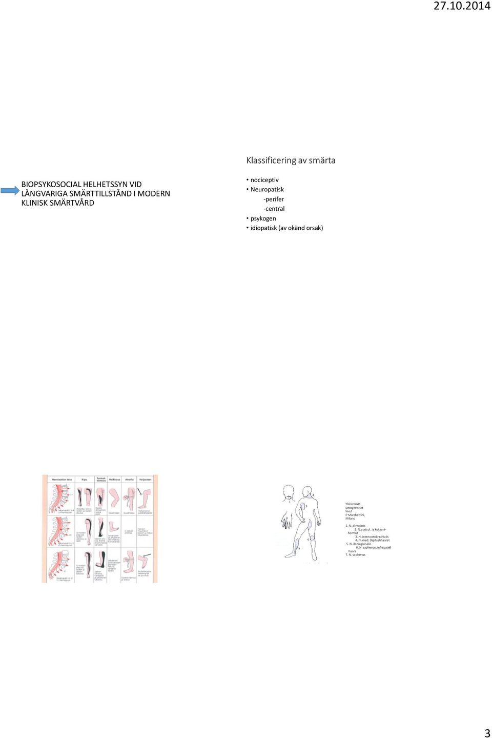 iatrogeeniset kivut P Marchettini, Milano 1. N. alveolaris 2. N.auricul. Ja kutaanihermot 3. N. intercostobrachialis 4.