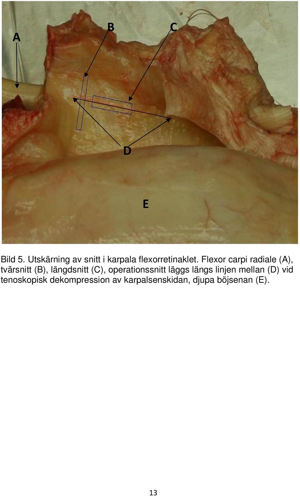 Flexor carpi radiale (A), tvärsnitt (B), längdsnitt (C),