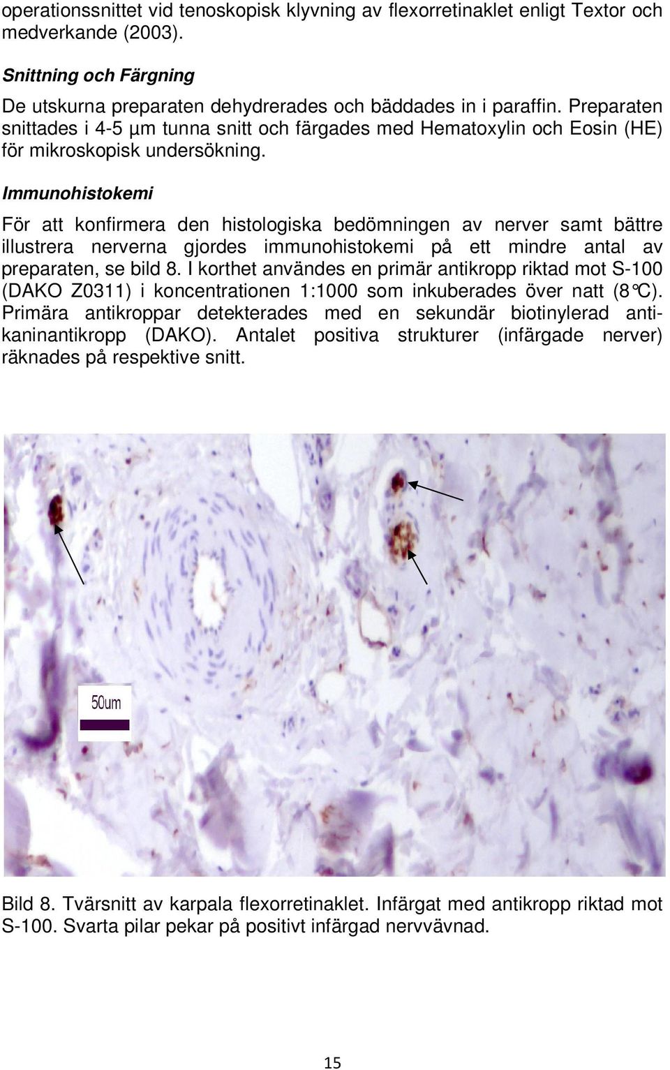 Immunohistokemi För att konfirmera den histologiska bedömningen av nerver samt bättre illustrera nerverna gjordes immunohistokemi på ett mindre antal av preparaten, se bild 8.