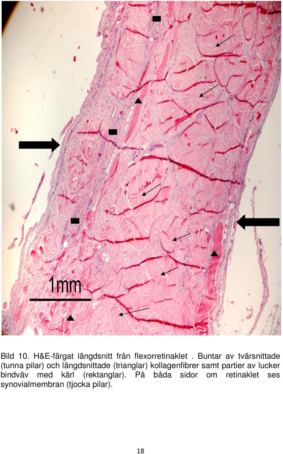 (trianglar) kollagenfibrer samt partier av lucker bindväv med