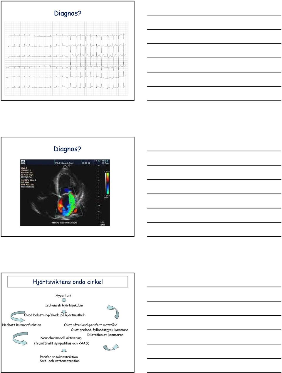 hjärtmuskeln Nedsatt kammarfunktion Ökat afterload-perifert motstånd Ökat