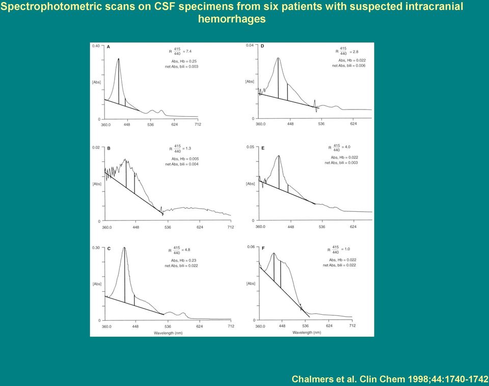 suspected intracranial hemorrhages