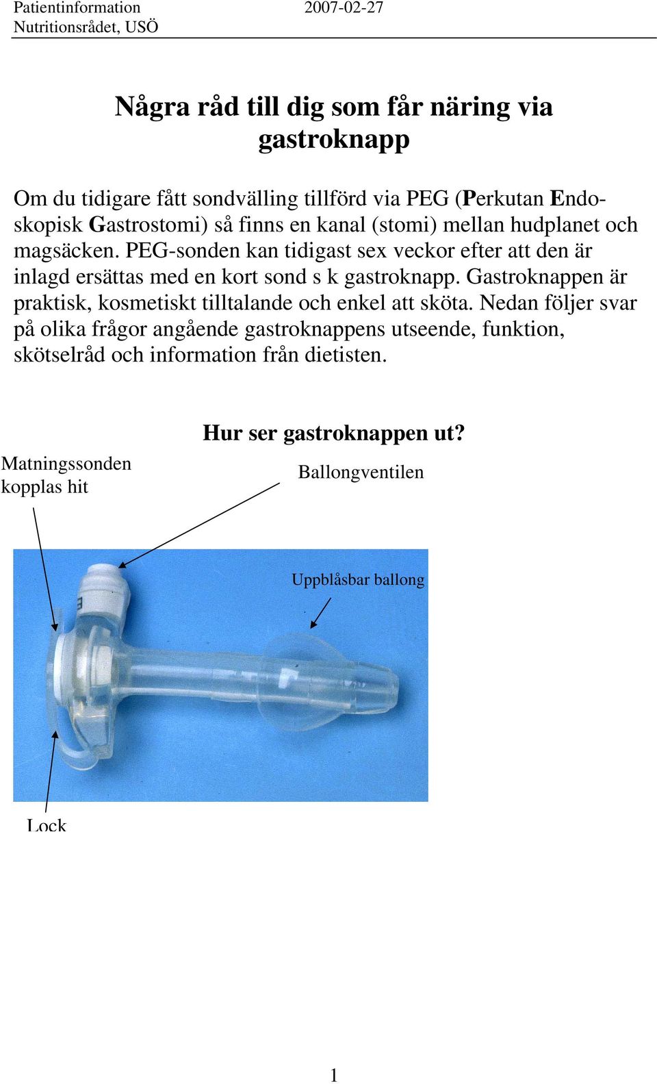 PEG-sonden kan tidigast sex veckor efter att den är inlagd ersättas med en kort sond s k gastroknapp.