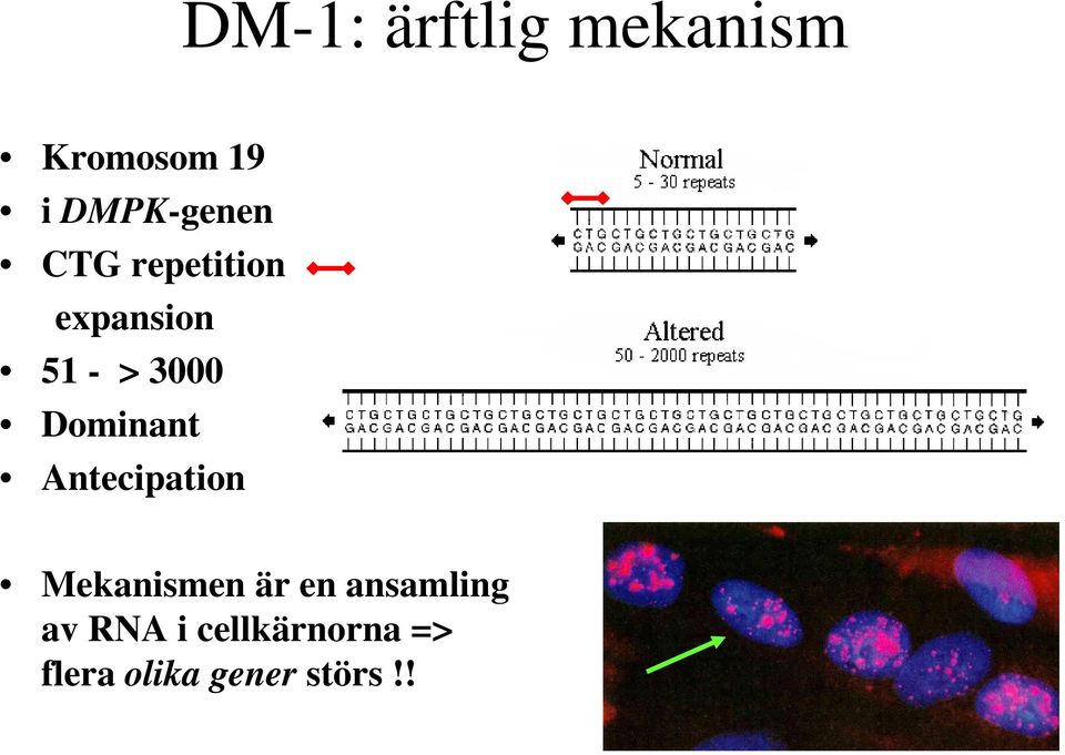 3000 Dominant Antecipation Mekanismen är en