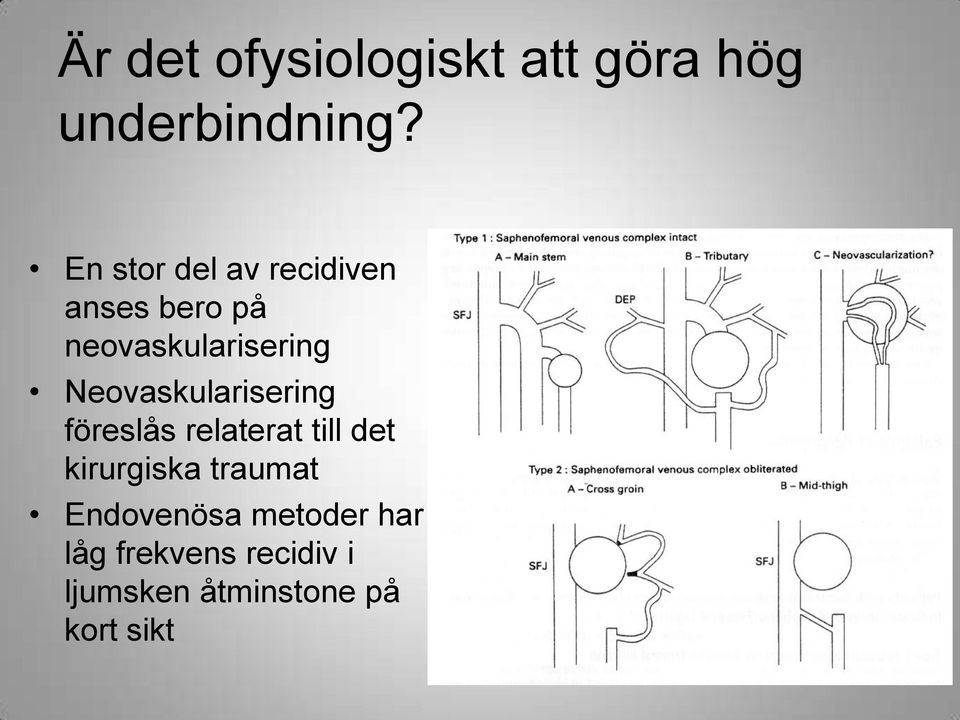 Neovaskularisering föreslås relaterat till det kirurgiska