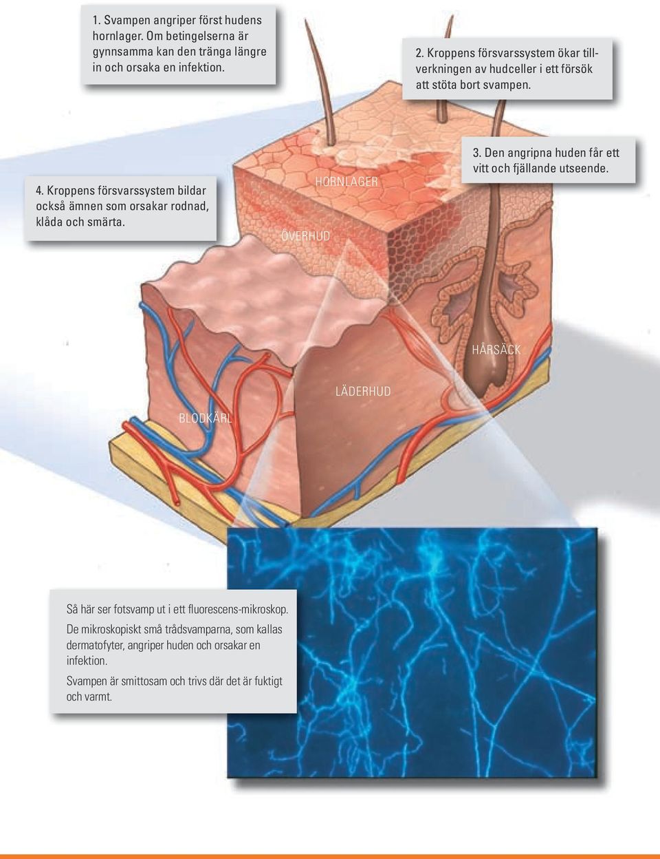 Kroppens försvarssystem bildar också ämnen som orsakar rodnad, klåda och smärta. överhud Hornlager 3.