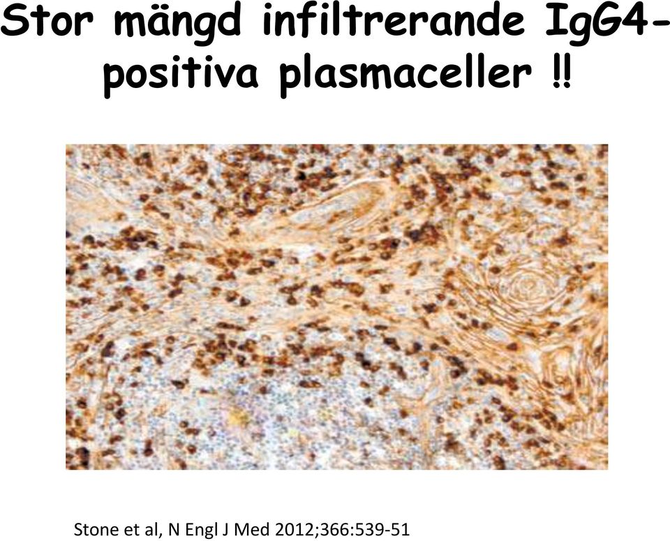 positiva plasmaceller!