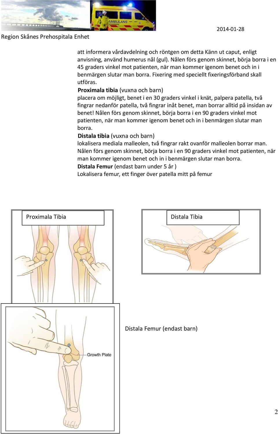 Proximala tibia (vuxna och barn) placera om möjligt, benet i en 30 graders vinkel i knät, palpera patella, två fingrar nedanför patella, två fingrar inåt benet, man borrar alltid på insidan av benet!