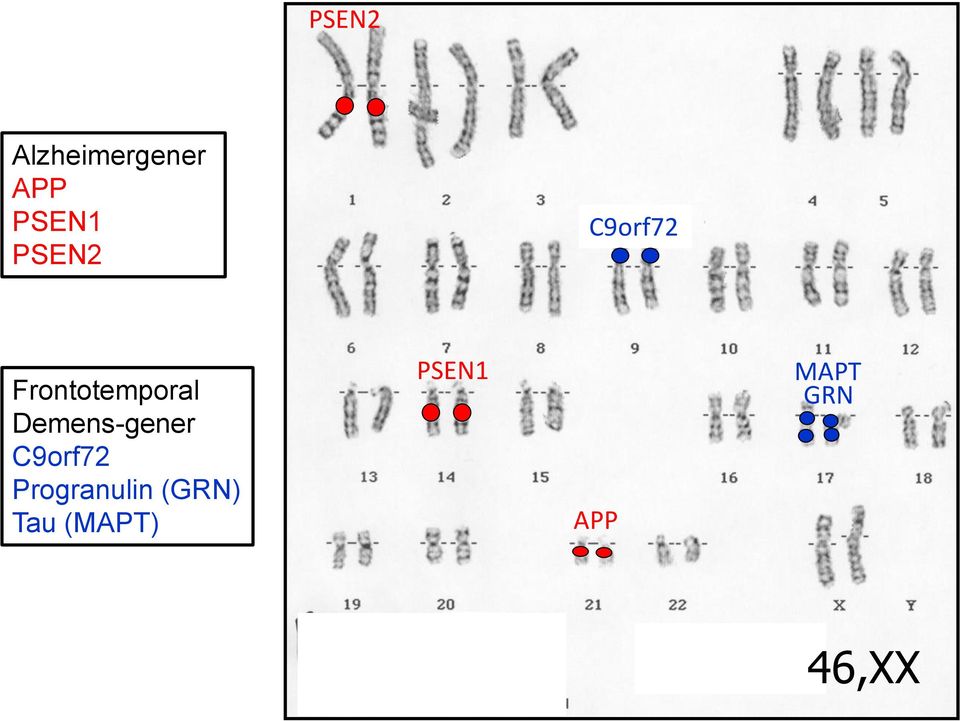 Demens-gener C9orf72 Progranulin