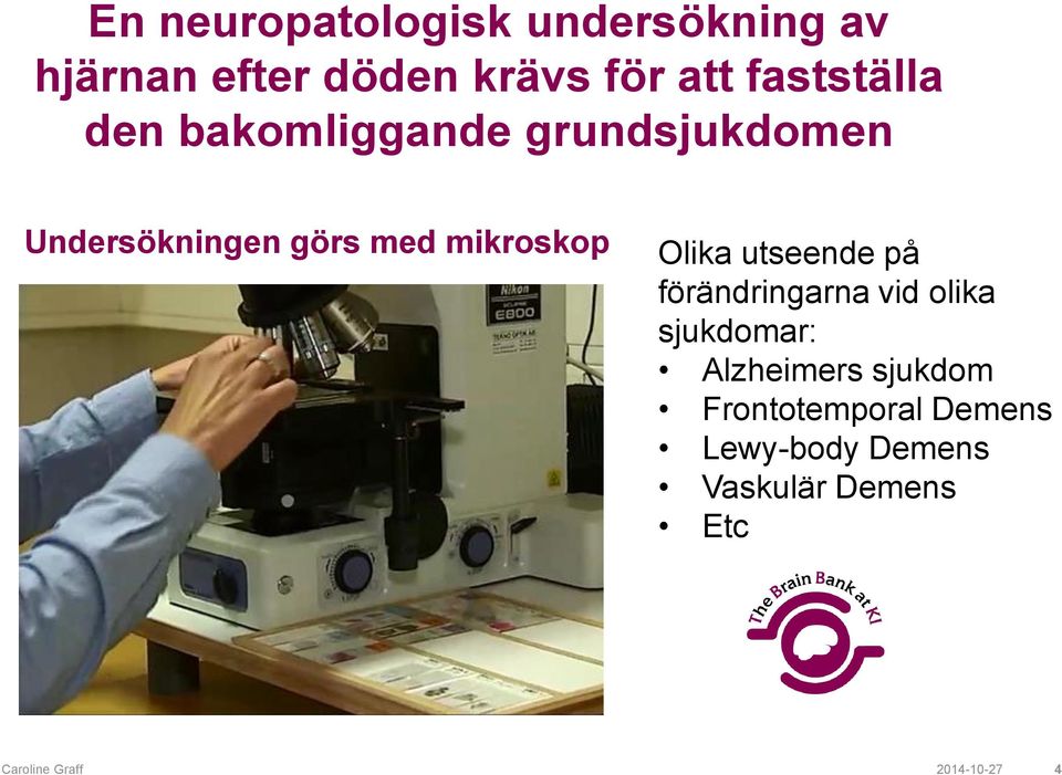 mikroskop Olika utseende på förändringarna vid olika sjukdomar: Alzheimers