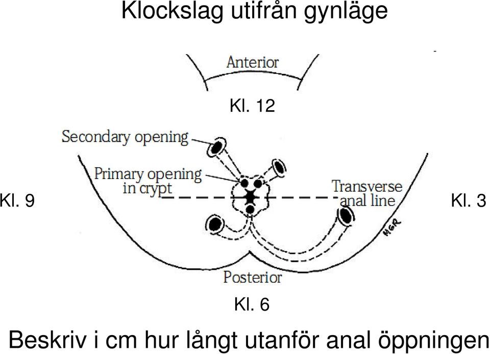 3 Kl. 6 Beskriv i cm