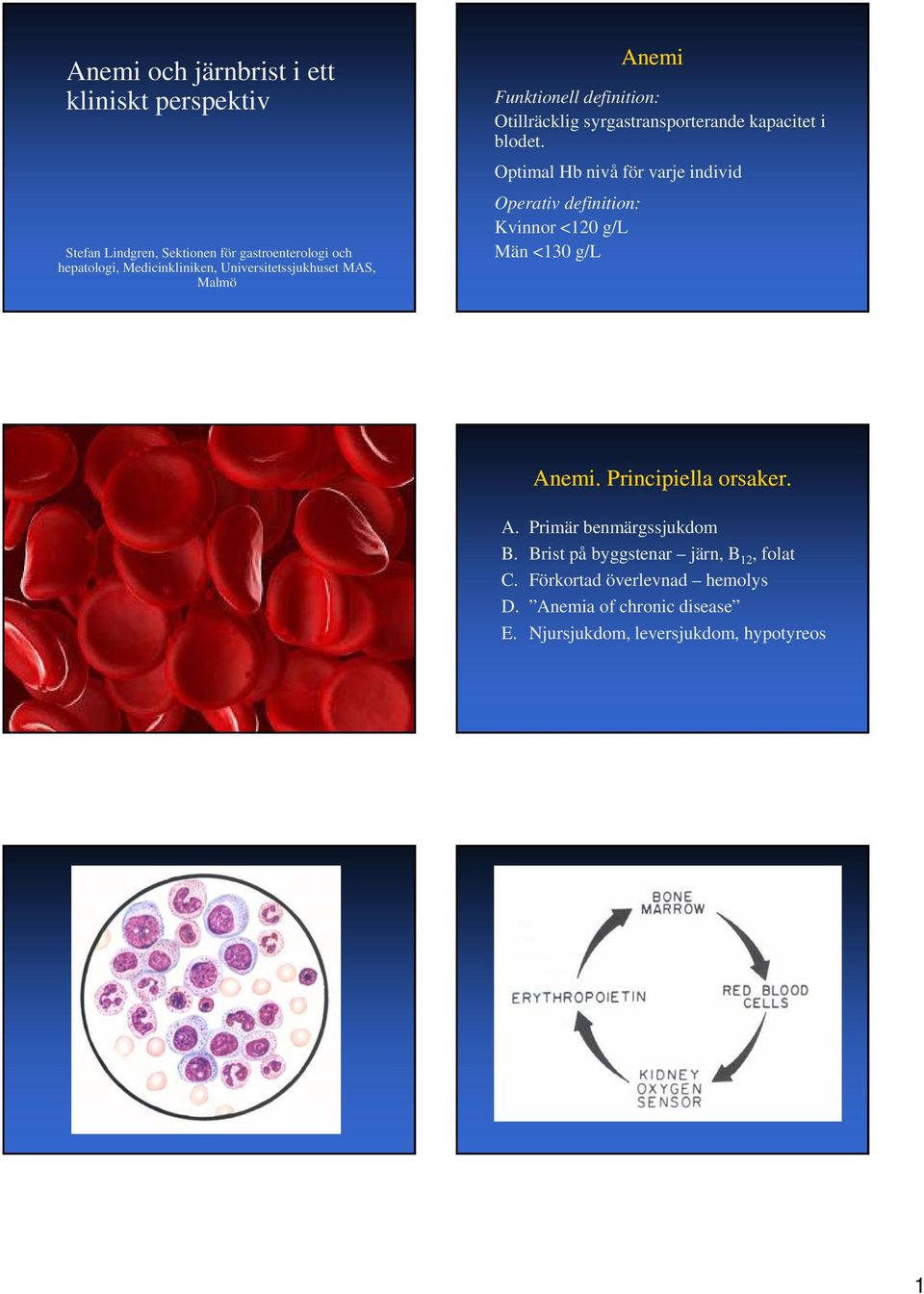Optimal Hb nivå för varje individ Operativ definition: Kvinnor <120 g/l Män <130 g/l Anemi. Principiella orsaker. A. Primär benmärgssjukdom B.