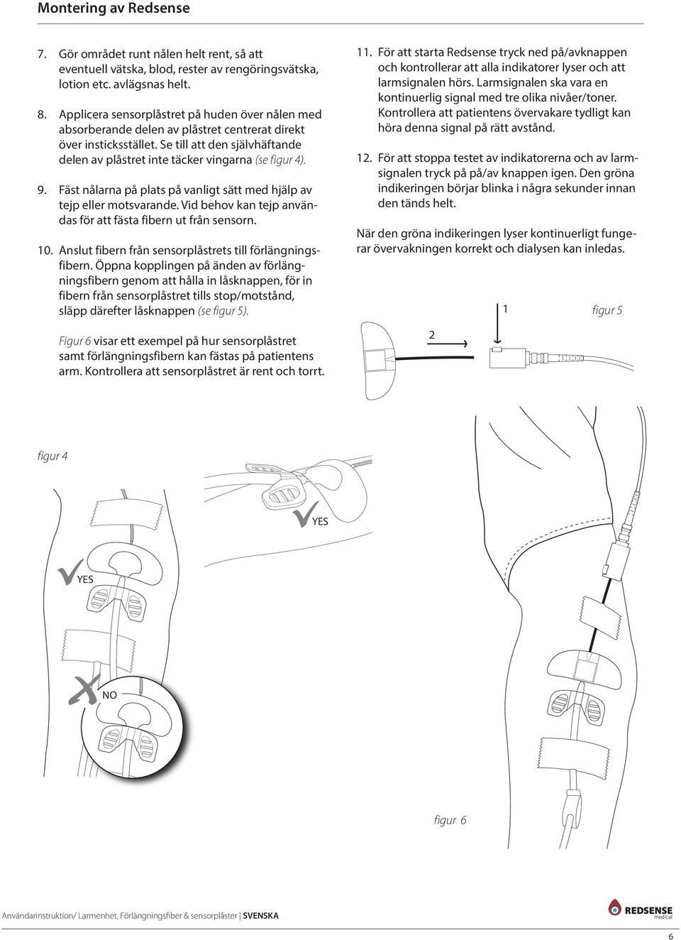 Se till att den självhäftande delen av plåstret inte täcker vingarna (se figur 4). 9. Fäst nålarna på plats på vanligt sätt med hjälp av tejp eller motsvarande.