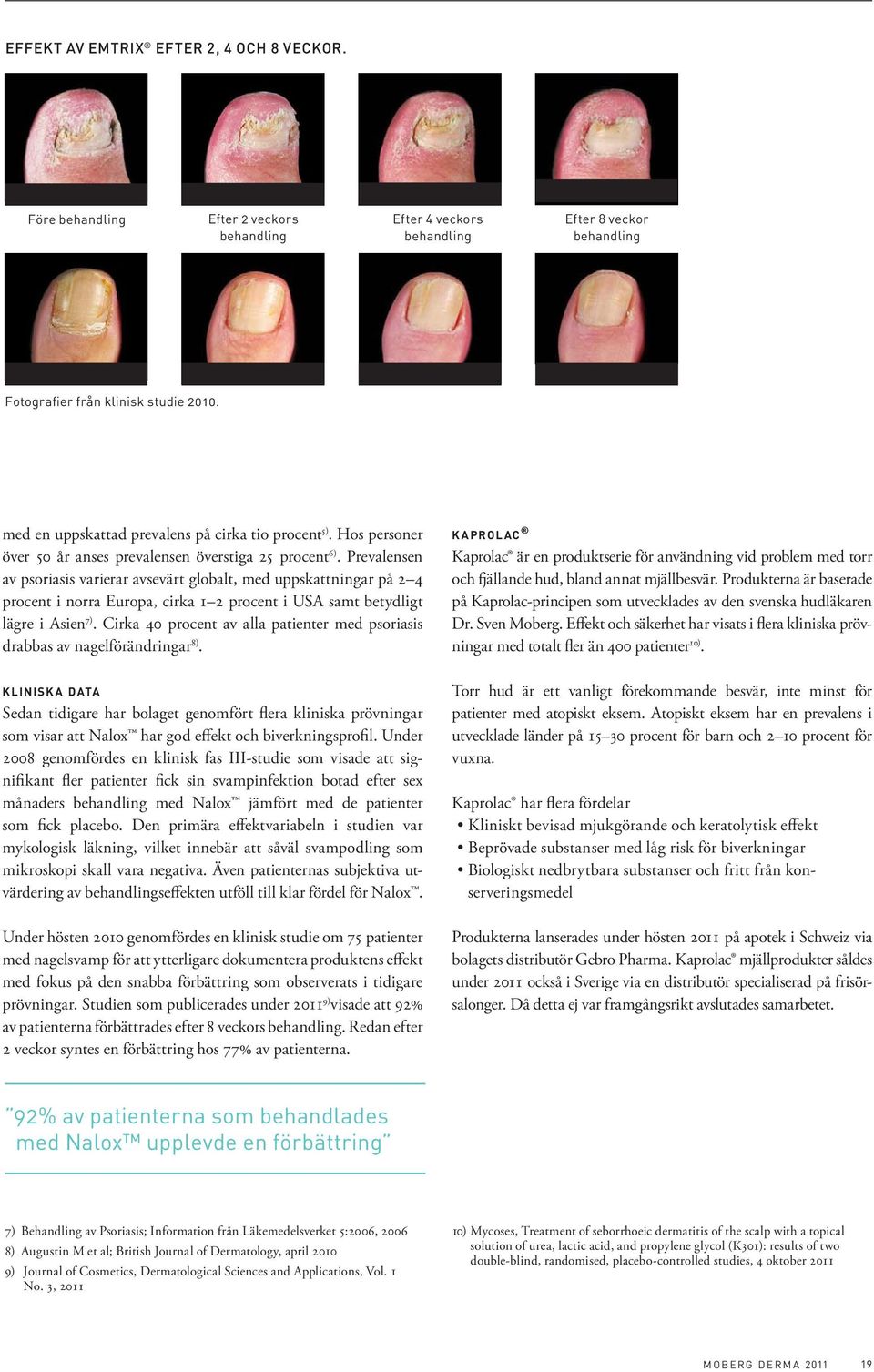 Prevalensen av psoriasis varierar avsevärt globalt, med uppskattningar på 2 4 procent i norra Europa, cirka 1 2 procent i USA samt betydligt lägre i Asien 7).