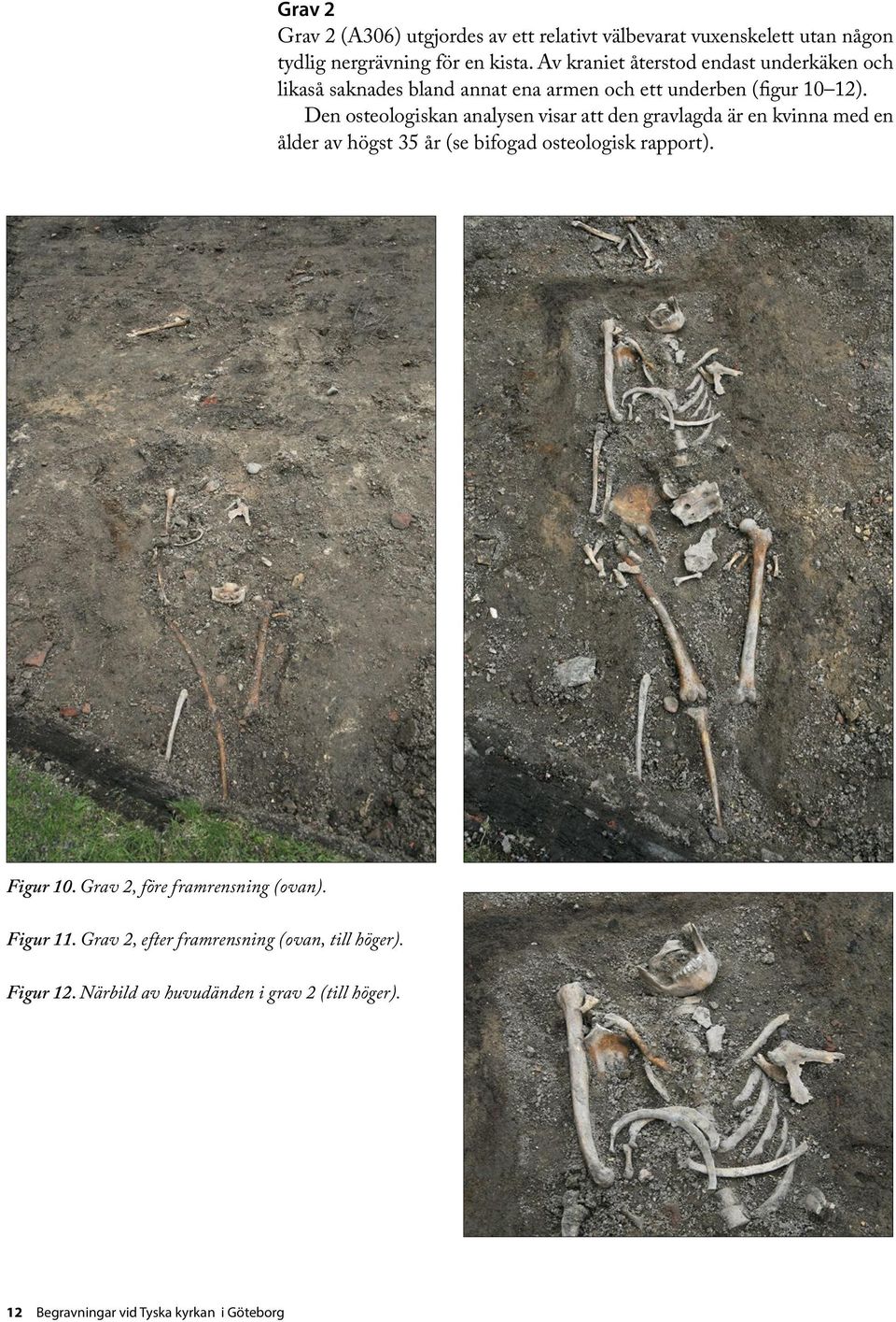 Den osteologiskan analysen visar att den gravlagda är en kvinna med en ålder av högst 35 år (se bifogad osteologisk rapport). Figur 10.