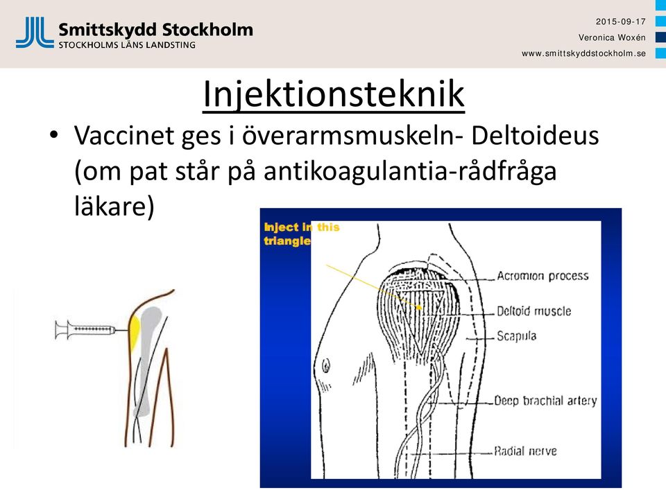 Deltoideus (om pat står på