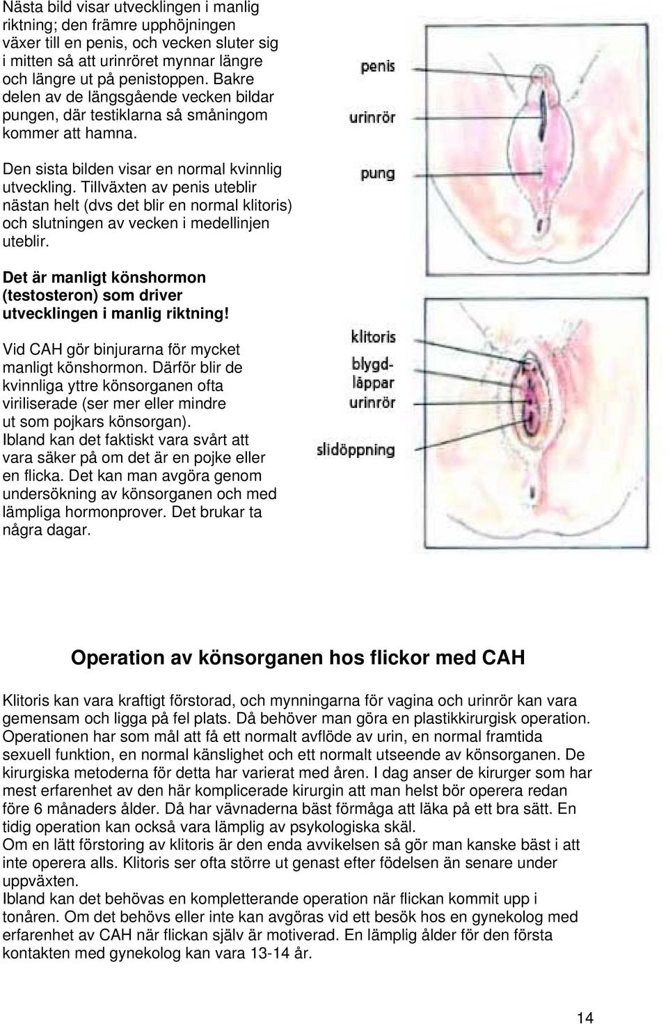 Tillväxten av penis uteblir nästan helt (dvs det blir en normal klitoris) och slutningen av vecken i medellinjen uteblir.