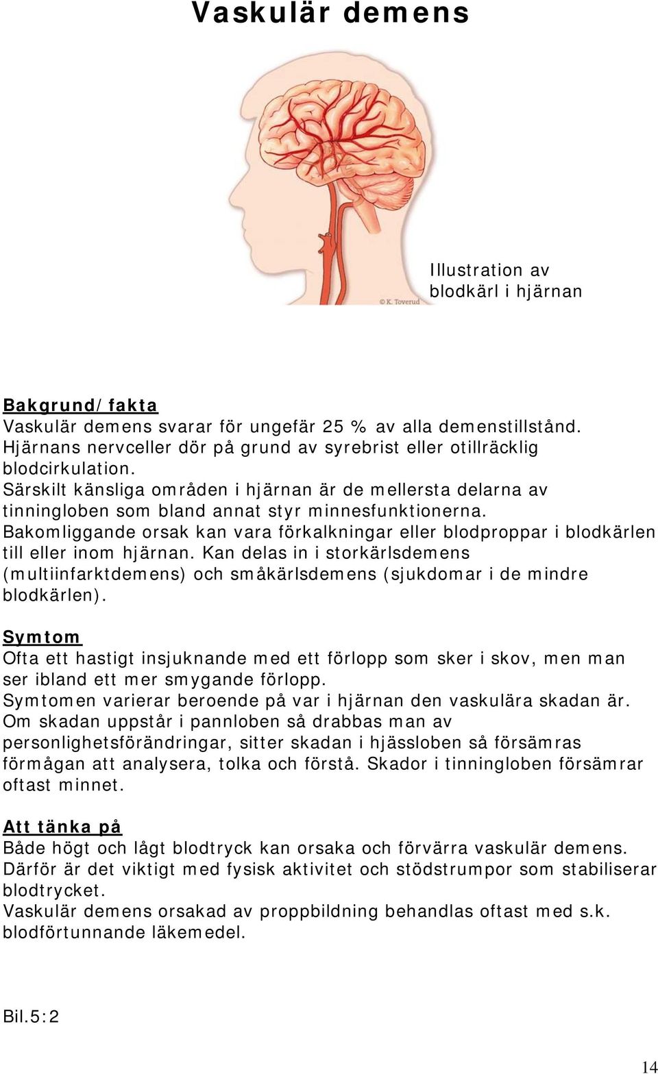 Bakomliggande orsak kan vara förkalkningar eller blodproppar i blodkärlen till eller inom hjärnan.