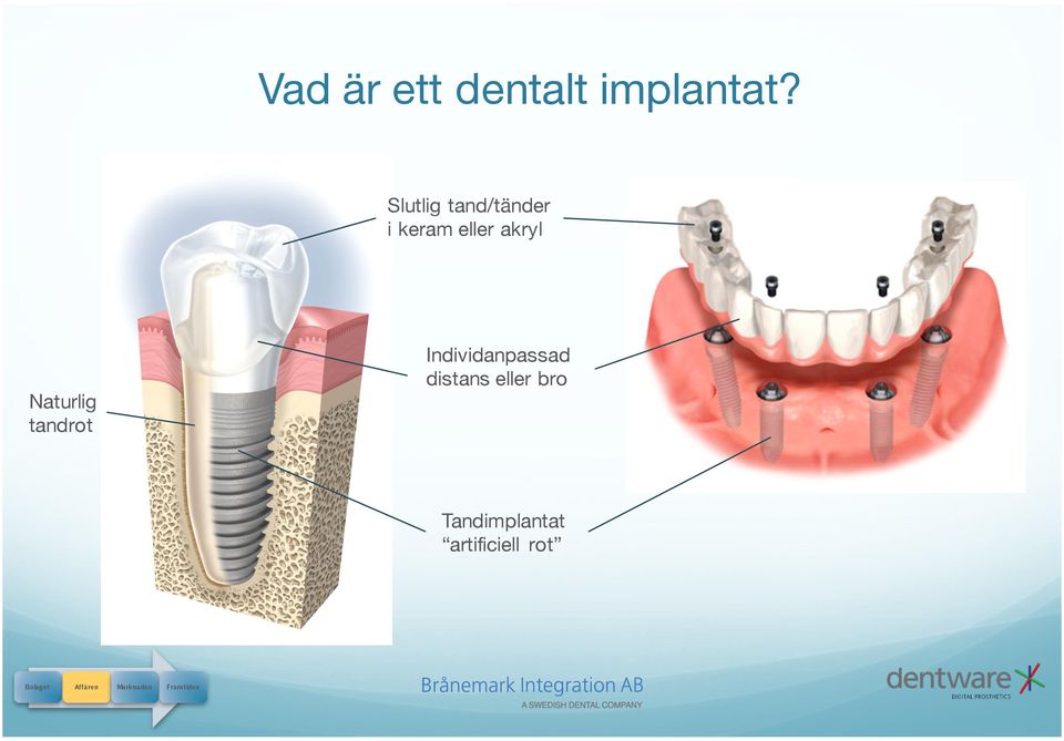 Naturlig tandrot Individanpassad distans eller