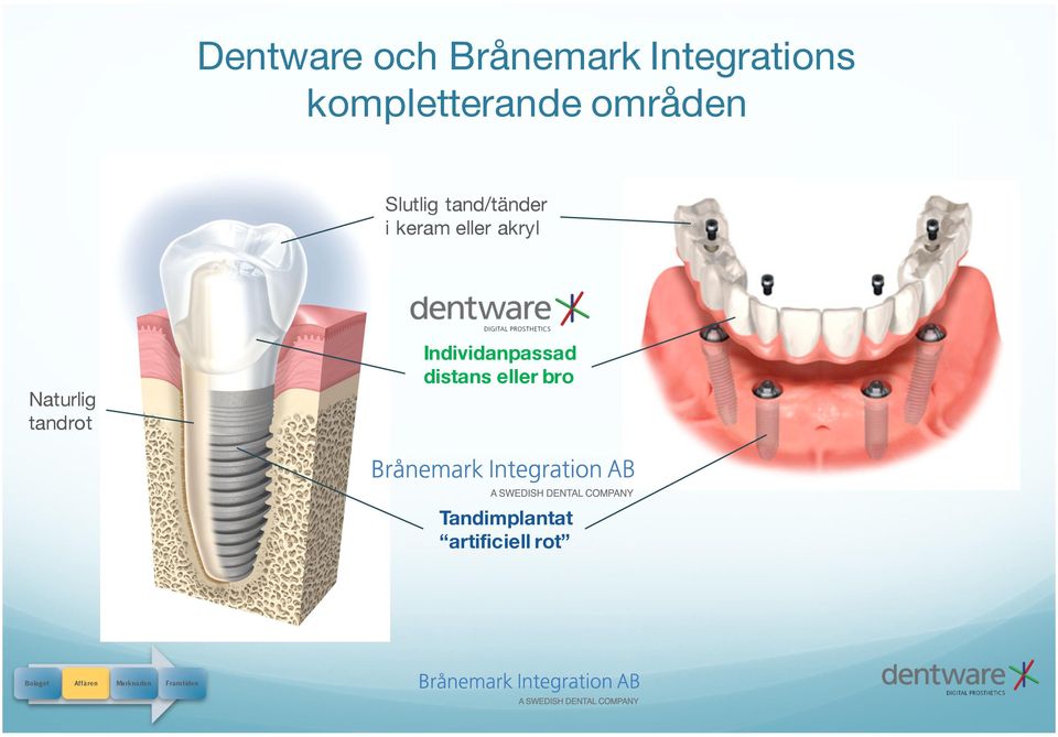 Naturlig tandrot Individanpassad distans eller bro