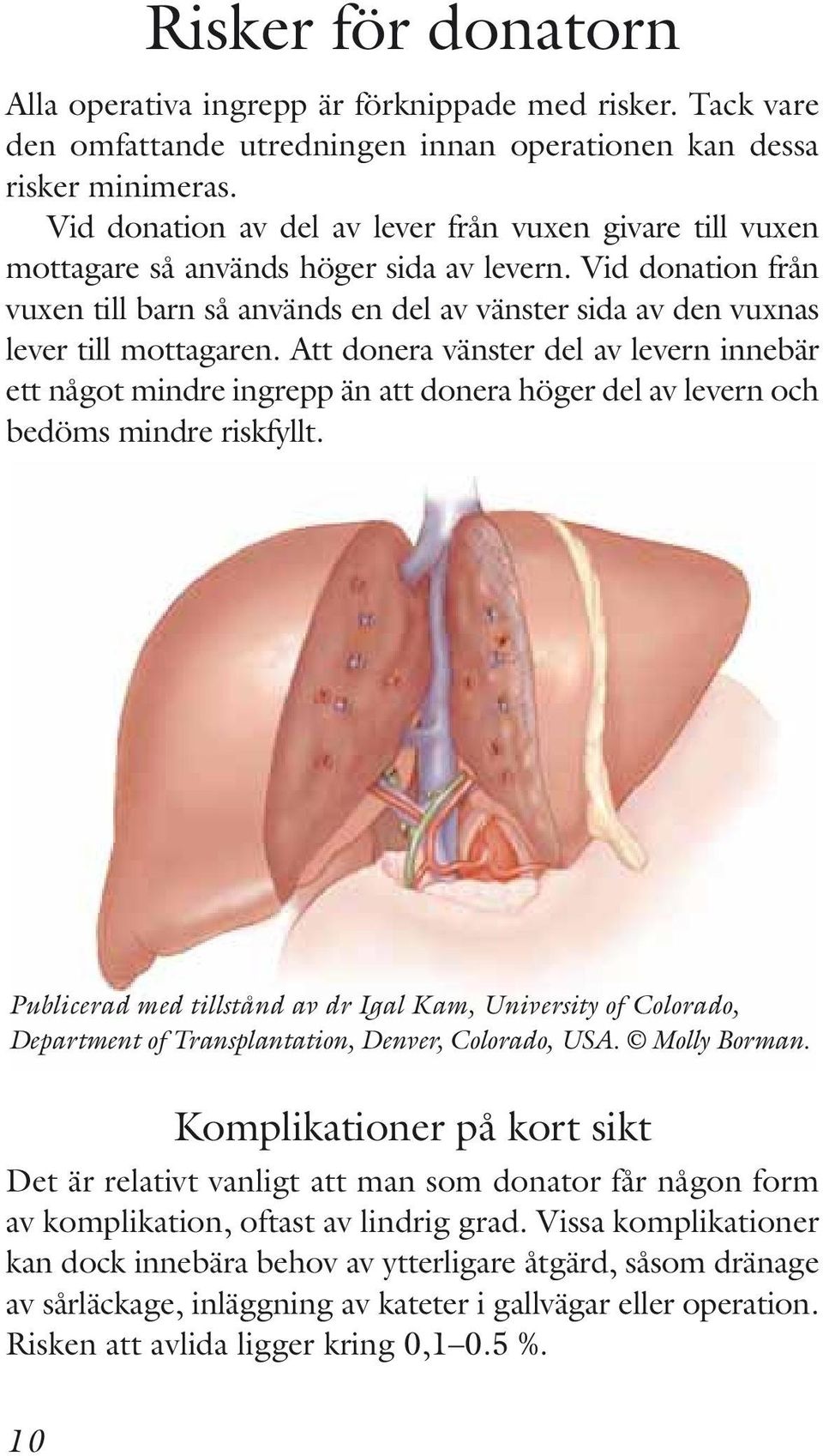 Vid donation från vuxen till barn så används en del av vänster sida av den vuxnas lever till mottagaren.