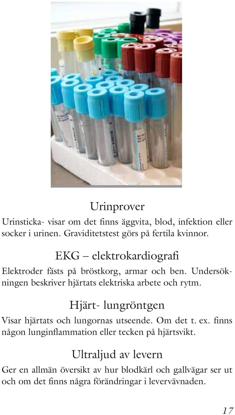 Hjärt- lungröntgen Visar hjärtats och lungornas utseende. Om det t. ex. finns någon lunginflammation eller tecken på hjärtsvikt.