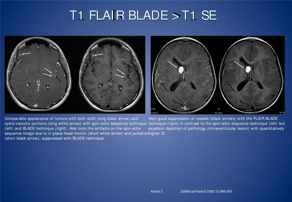 and BLADE technique (right).