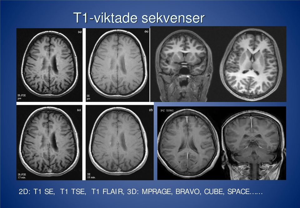 SE, T1 TSE, T1