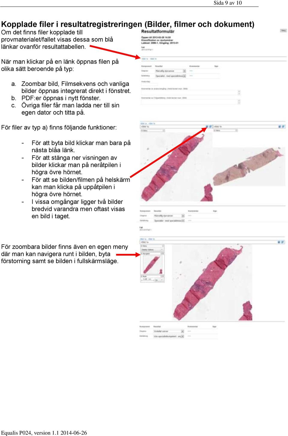 Övriga filer får man ladda ner till sin egen dator och titta på. För filer av typ a) finns följande funktioner: - För att byta bild klickar man bara på nästa blåa länk.