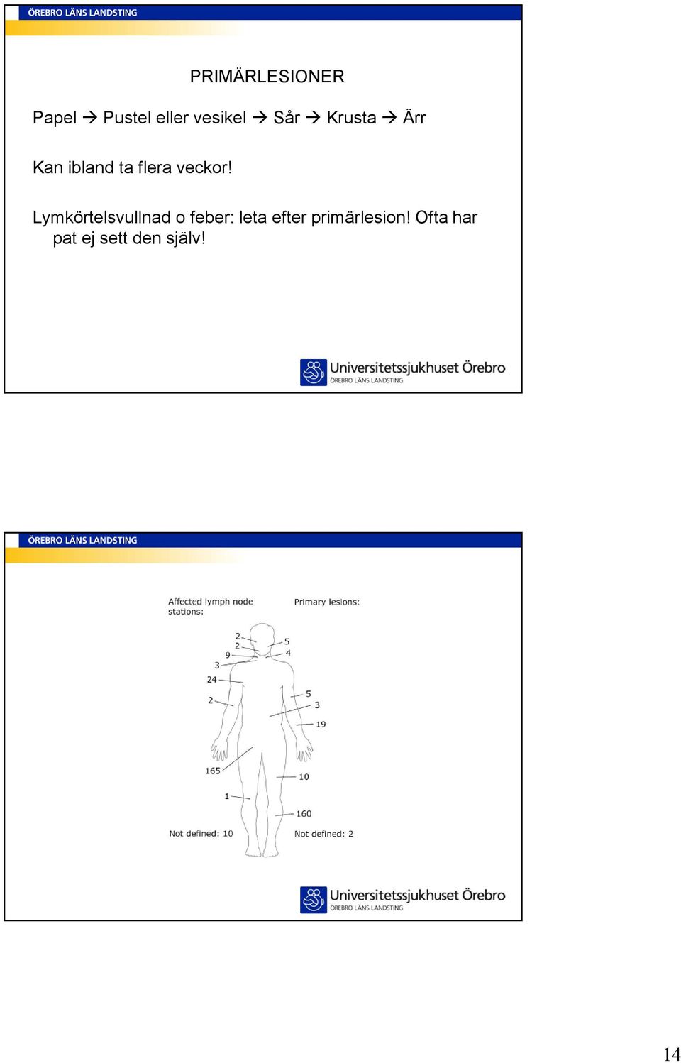 Lymkörtelsvullnad o feber: leta efter