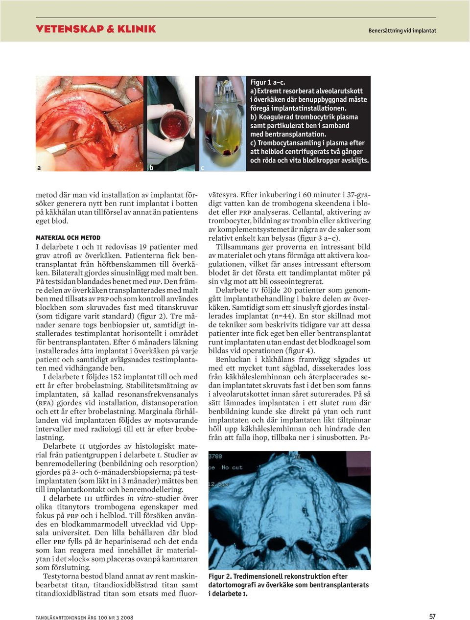 c) Trombocytansamling i plasma efter att helblod centrifugerats två gånger och röda och vita blodkroppar avskiljts.