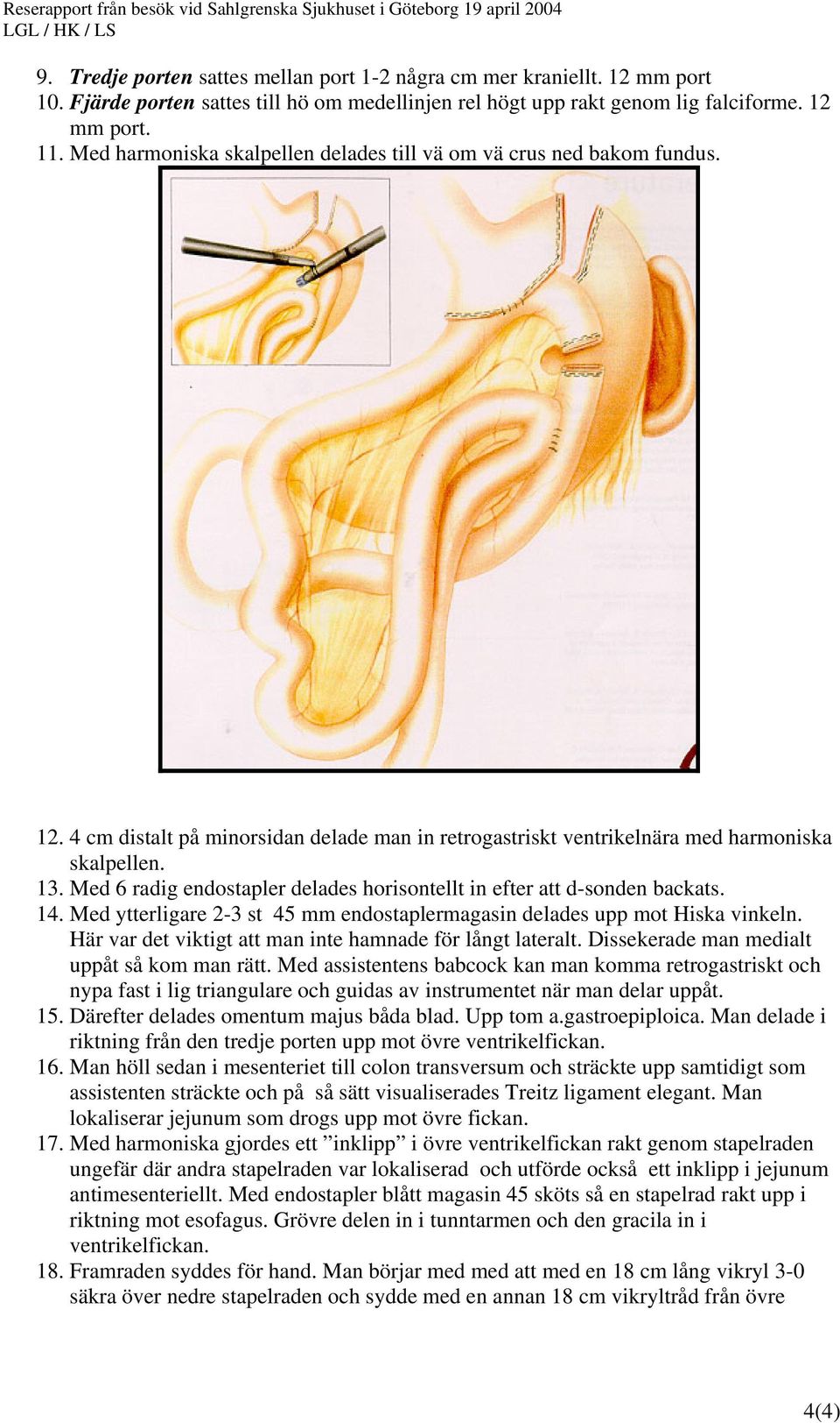 Med 6 radig endostapler delades horisontellt in efter att d-sonden backats. 14. Med ytterligare 2-3 st 45 mm endostaplermagasin delades upp mot Hiska vinkeln.