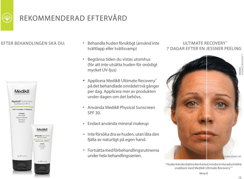 Applicera mer av produkten under dagen om det behövs. Använda Medik8 Physical Sunscreen SPF 30.