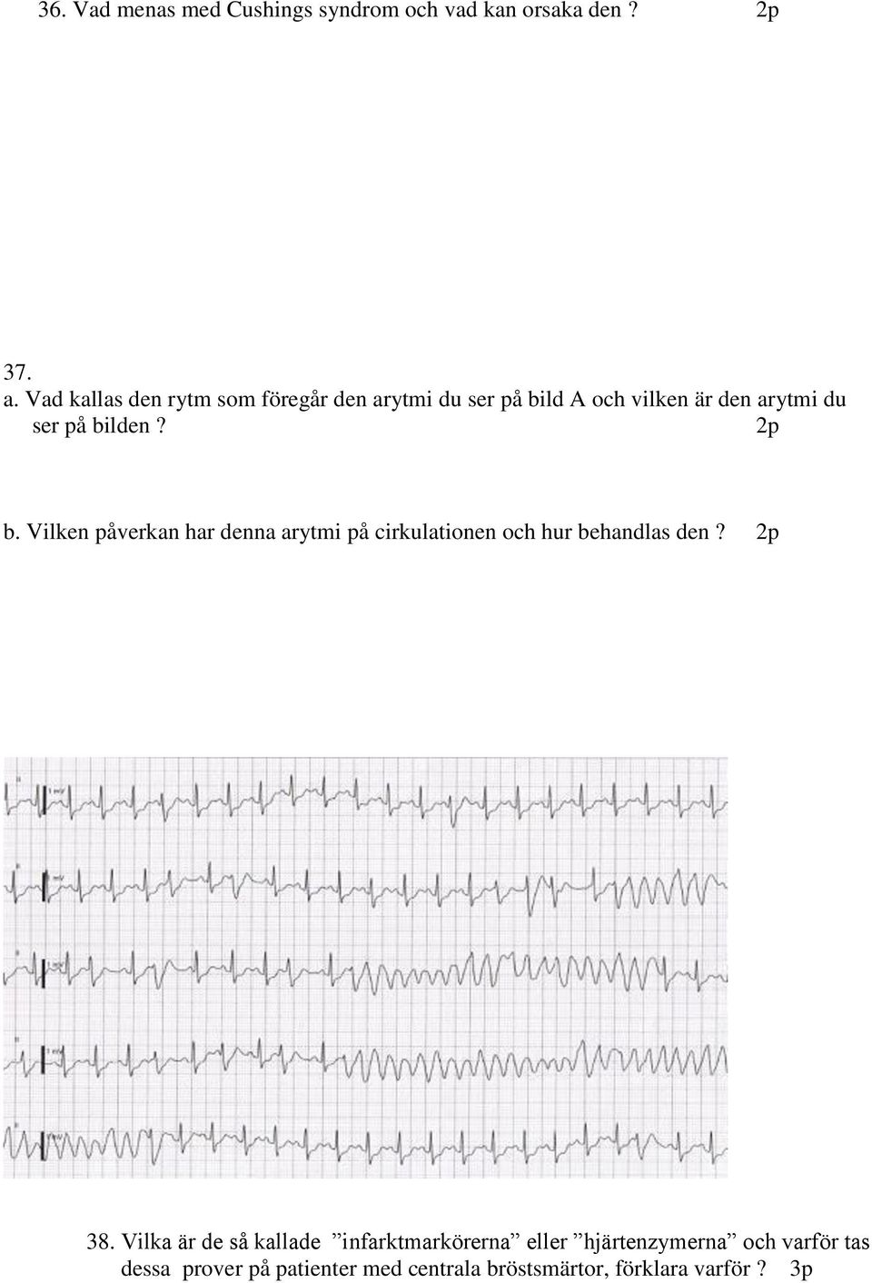 bilden? b. Vilken påverkan har denna arytmi på cirkulationen och hur behandlas den? 38.