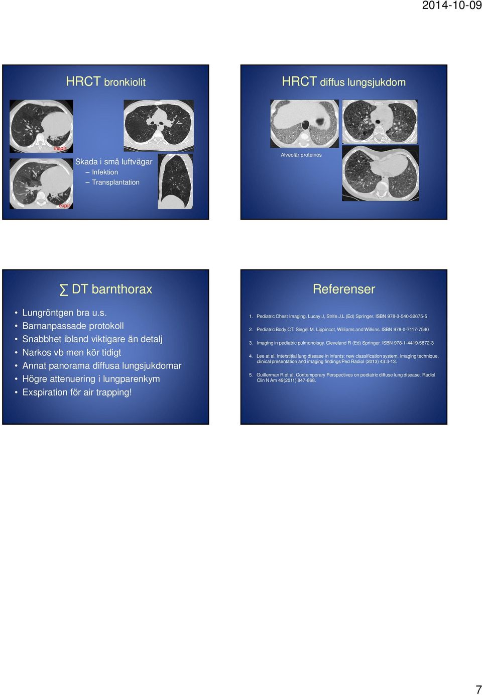 Referenser 1. Pediatric Chest Imaging. Lucay J, Strife J.L (Ed) Springer. ISBN 978-3-540-32675-5 2. Pediatric Body CT. Siegel M. Lippincot, Williams and Wilkins. ISBN 978-0-7117-7540 3.