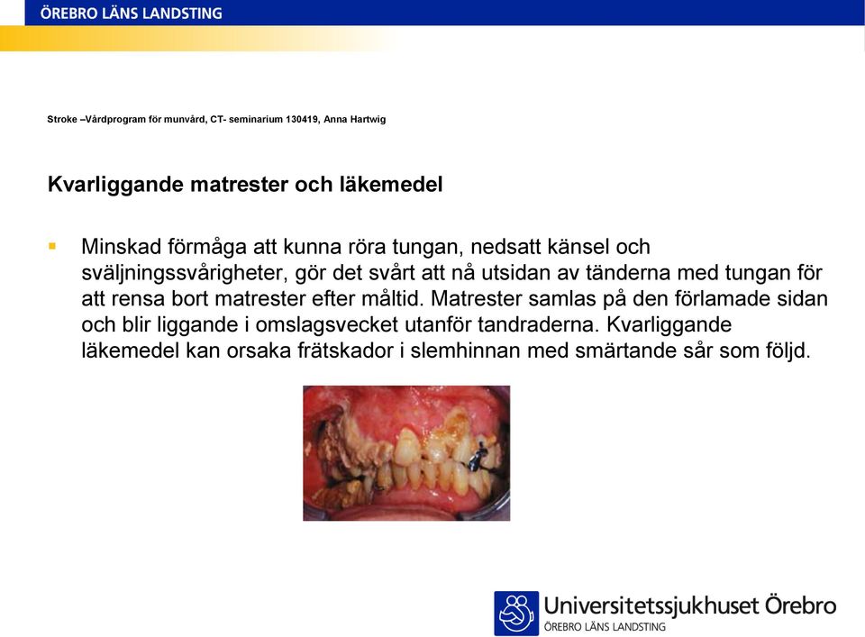 matrester efter måltid.