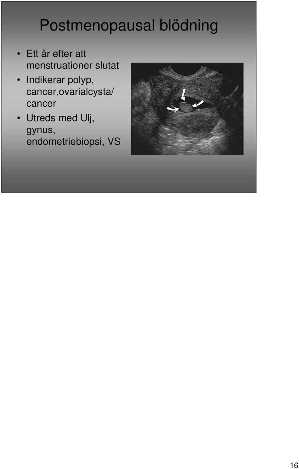 polyp, cancer,ovarialcysta/ cancer