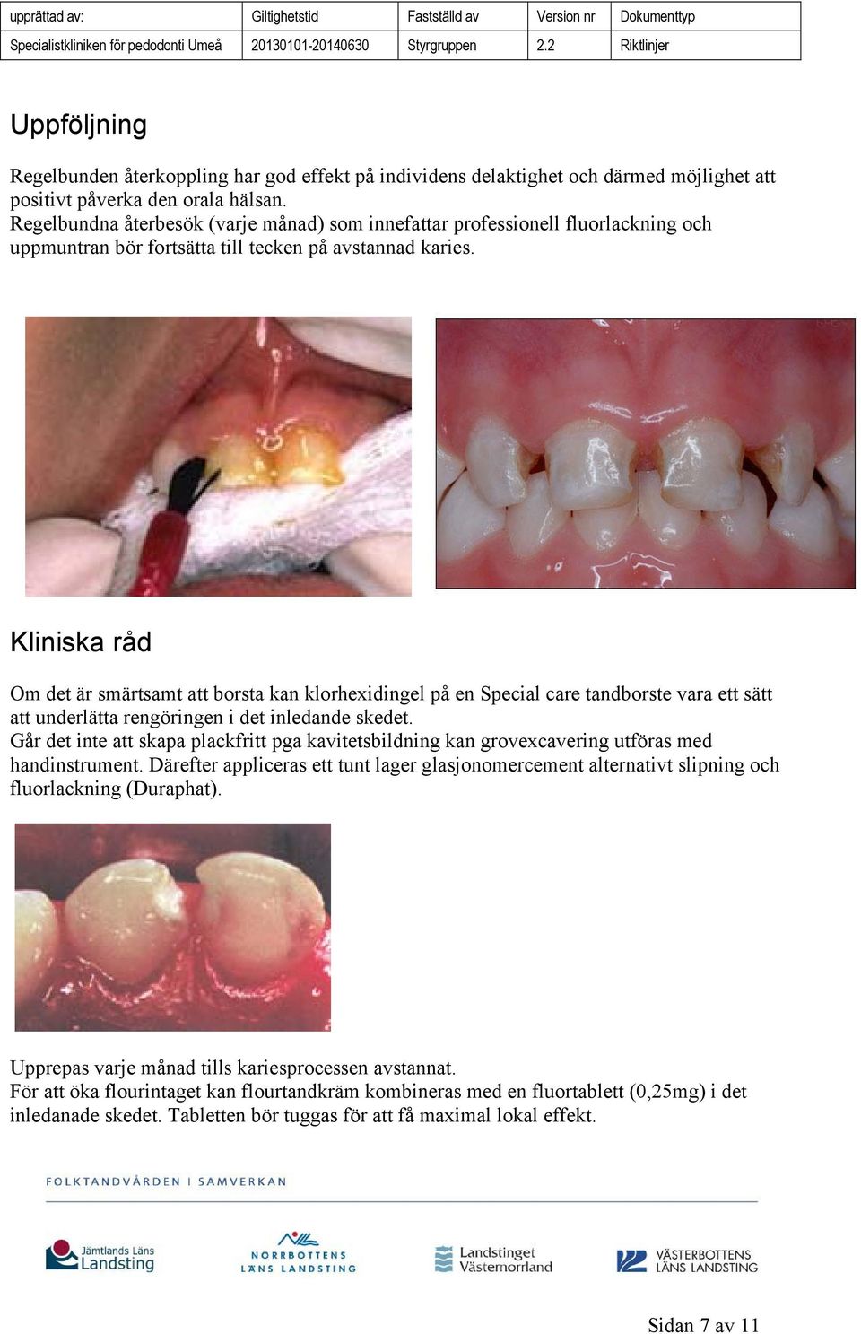 Kliniska råd Om det är smärtsamt att borsta kan klorhexidingel på en Special care tandborste vara ett sätt att underlätta rengöringen i det inledande skedet.
