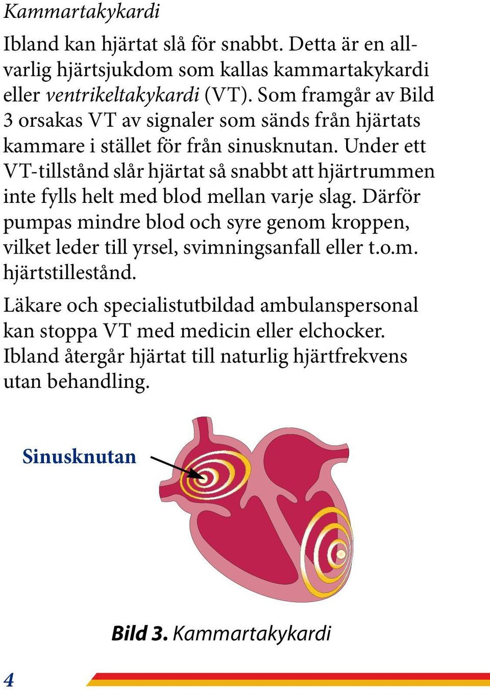 Under ett VT-tillstånd slår hjärtat så snabbt att hjärtrummen inte fylls helt med blod mellan varje slag.