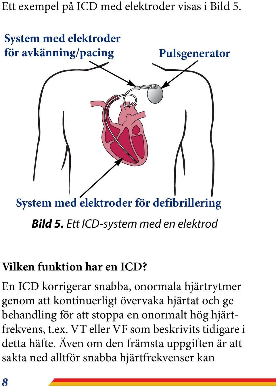 Ett ICD-system med en elektrod Vilken funktion har en ICD?