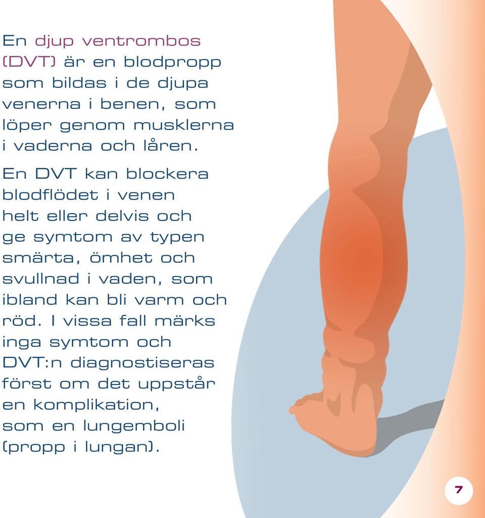 En DVT kan blockera blodflödet i venen helt eller delvis och ge symtom av typen smärta, ömhet och