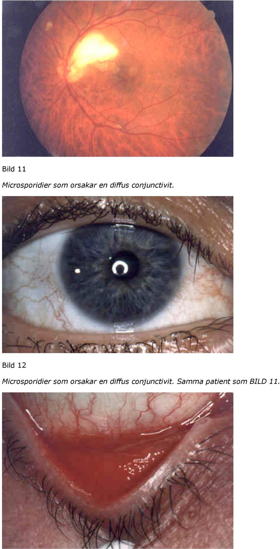Bild 12 Microsporidier som orsakar 