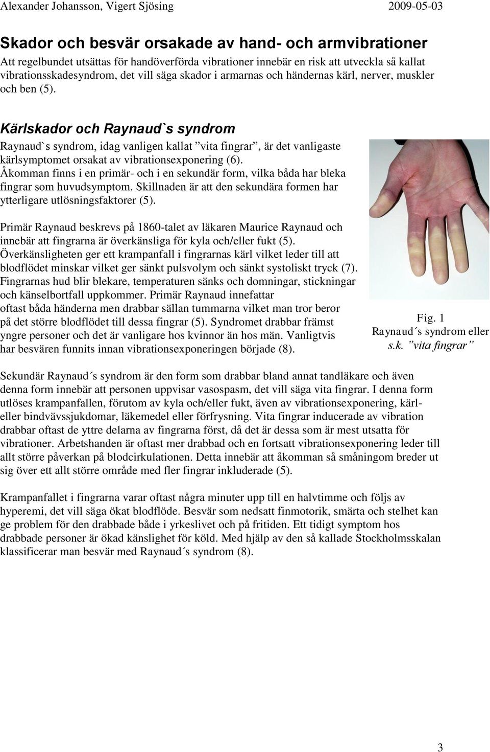 Kärlskador och Raynaud`s syndrom Raynaud`s syndrom, idag vanligen kallat vita fingrar, är det vanligaste kärlsymptomet orsakat av vibrationsexponering (6).