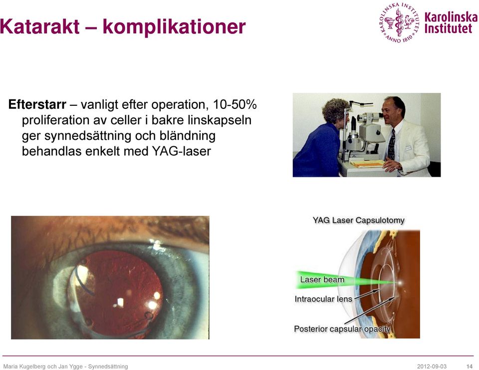 linskapseln ger synnedsättning och bländning behandlas