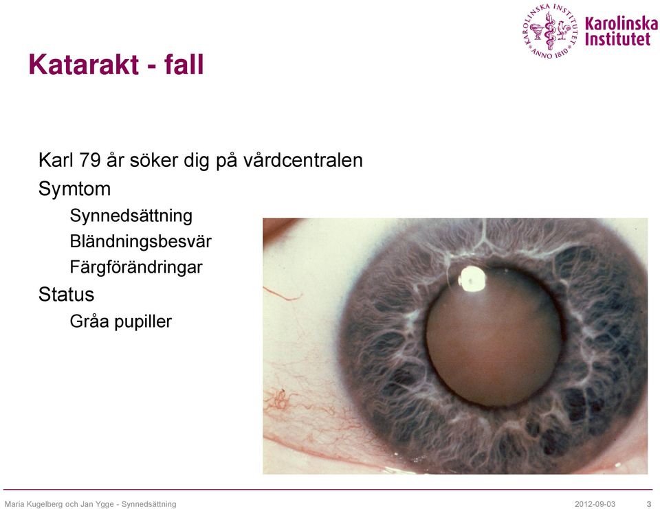 Bländningsbesvär Färgförändringar Status Gråa