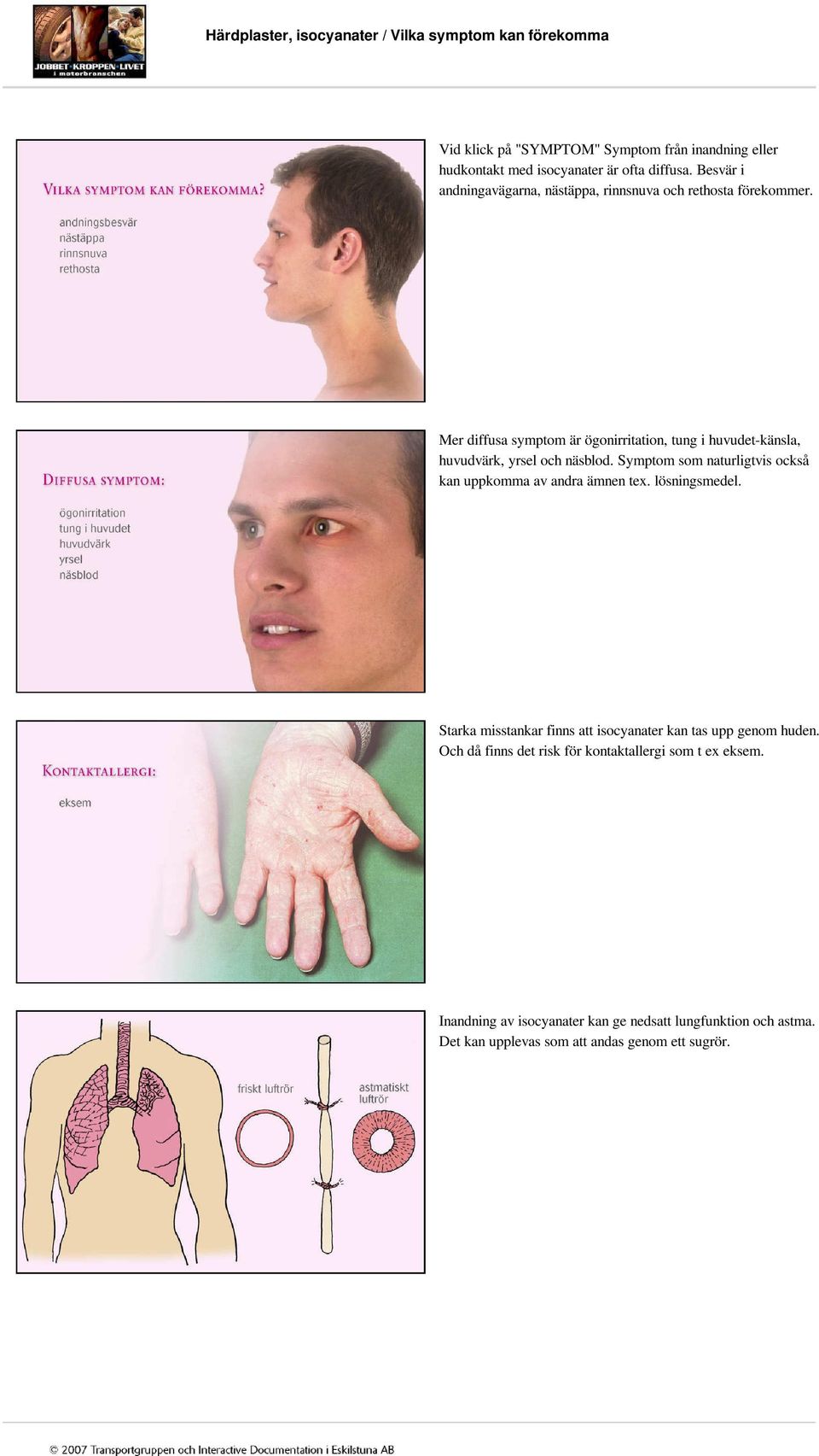 Mer diffusa symptom är ögonirritation, tung i huvudet-känsla, huvudvärk, yrsel och näsblod. Symptom som naturligtvis också kan uppkomma av andra ämnen tex.