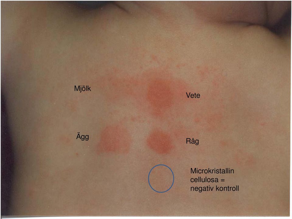 Microkristallin