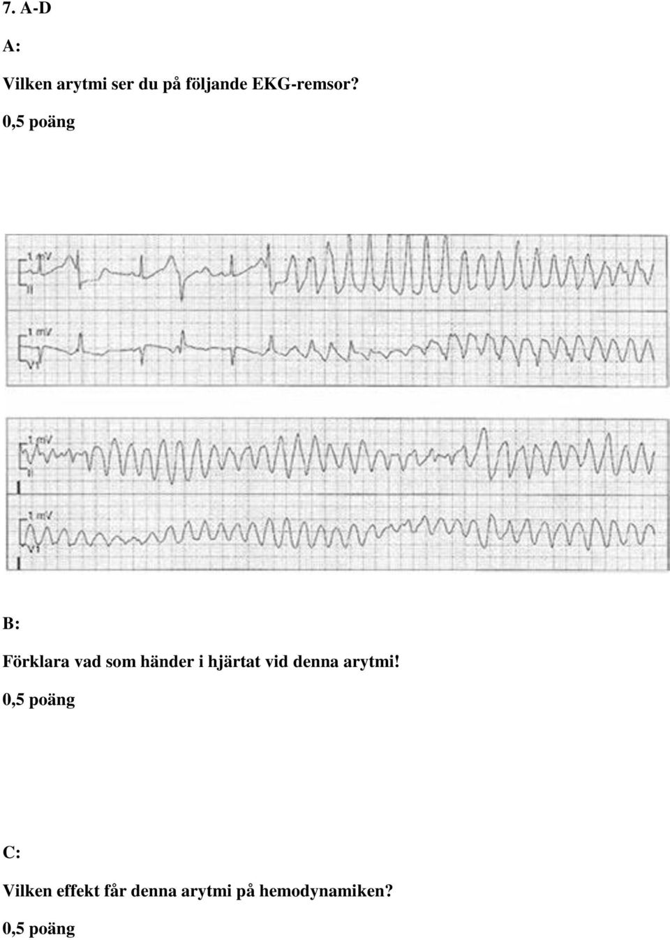 0,5 poäng B: Förklara vad som händer i hjärtat